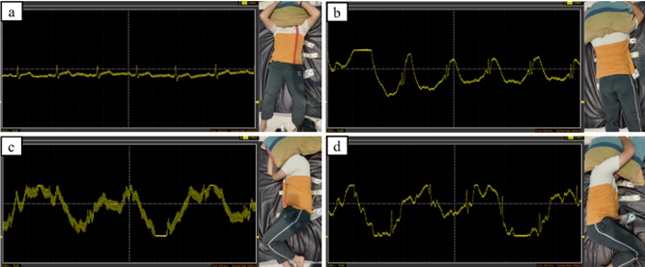 Contoh tampilan hasil pengolahan sinyal yang dikirimkan matras SleepCare dari berbagai posisi tidur pengguna